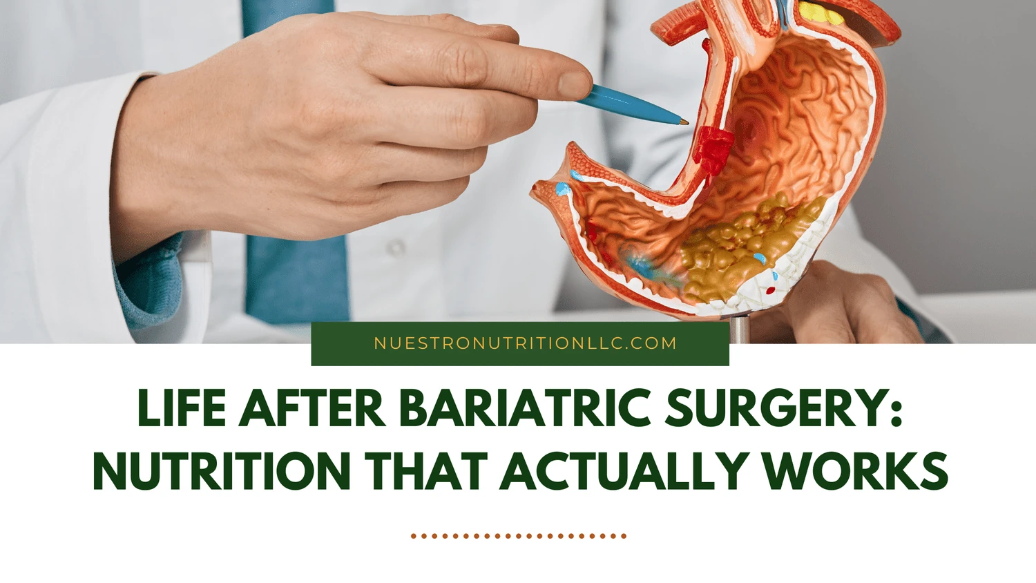 Life After Bariatric Surgery: Nutrition That Actually Works| Nuestro Nutrition LLC | Rio Grande Valley, Texas — original article banner